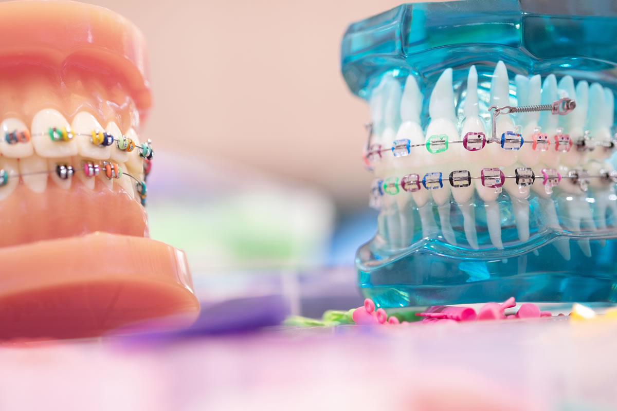 When Do I Really Need An Orthodontist?