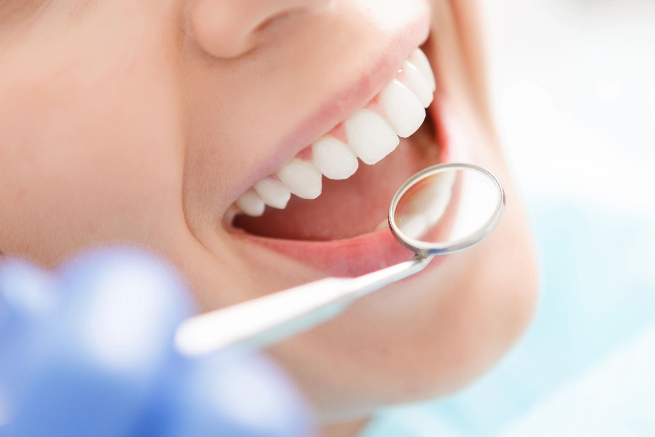 How Important Are Teeth Cleaning Appointments?