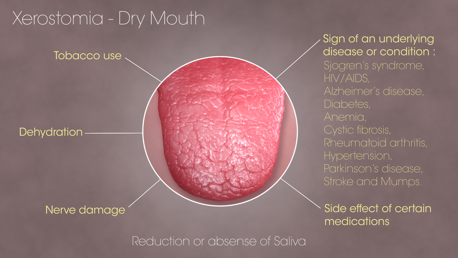 Dry Mouth and What You Can Do About It