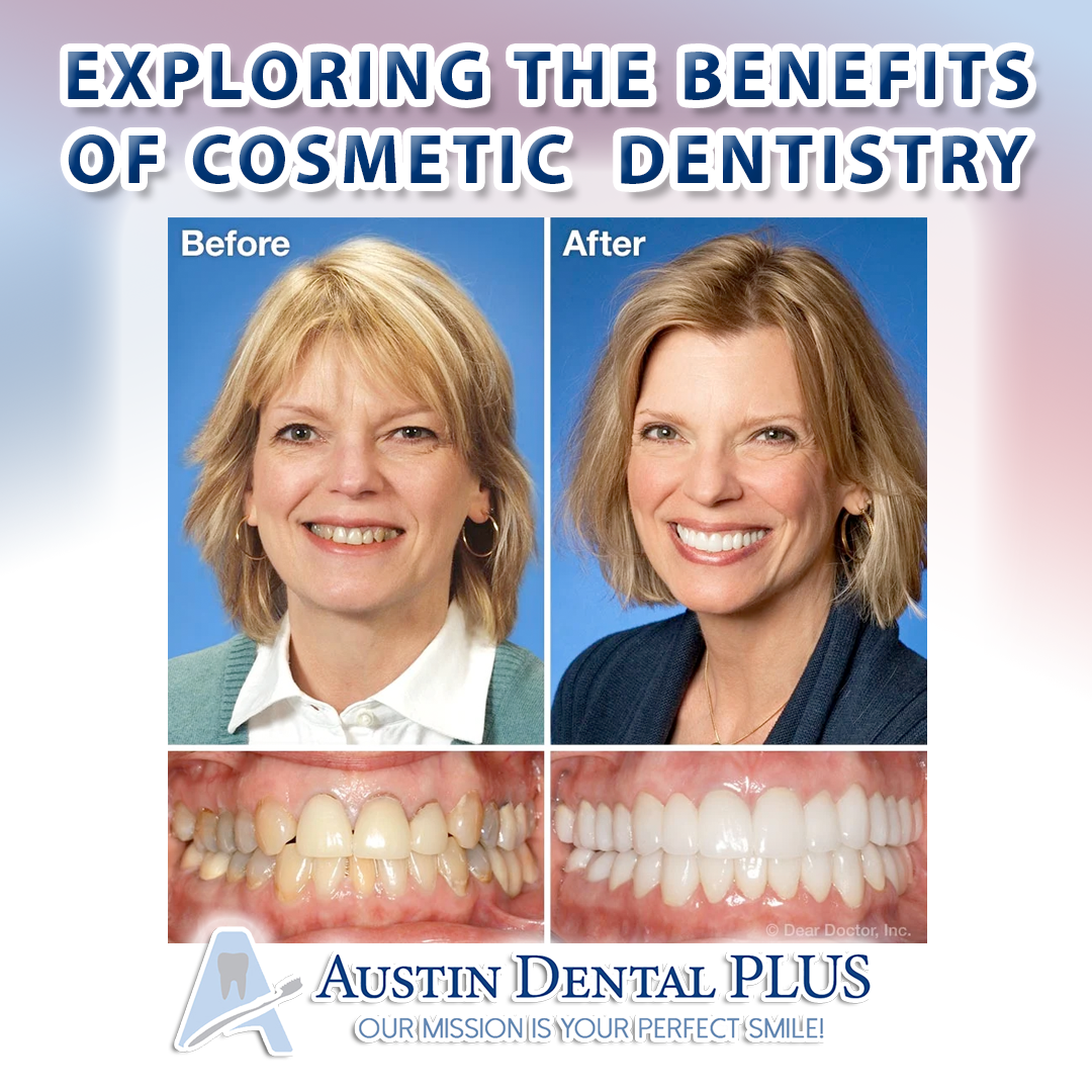 Transform Your Smile with Cosmetic Dentistry