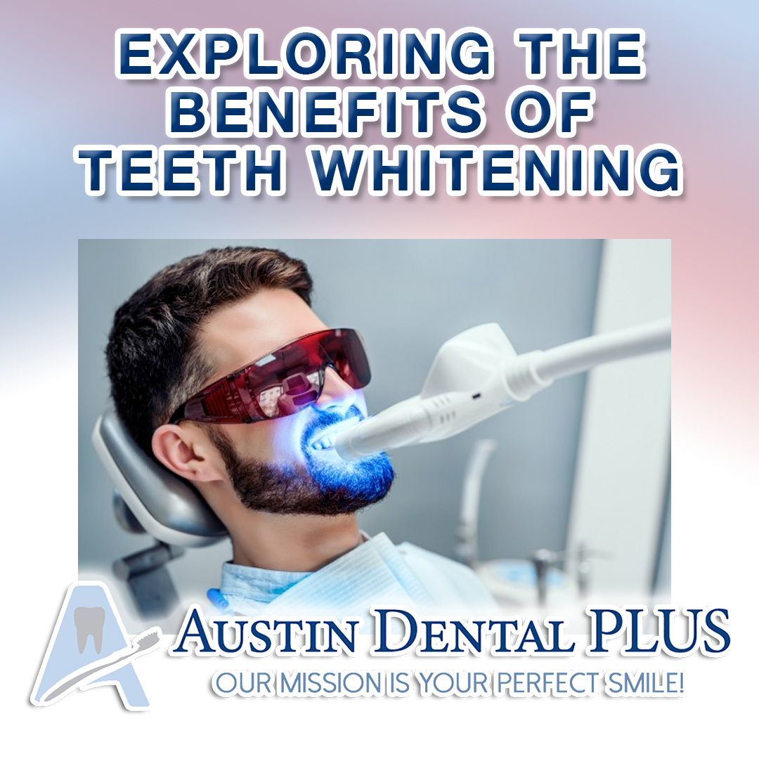 Why Teeth Whitening is Worth Considering